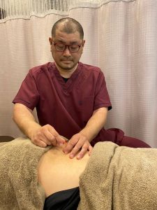 鍼灸師によるトリガーポイント鍼治療、神経・血流調整